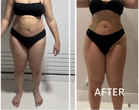 Antes e depois de aluna após 15 dias de treino e dieta